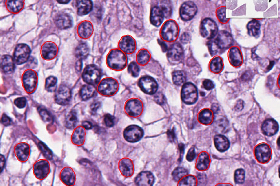 atroficheskiy-gastrit.jpg